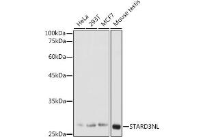 Western blot analysis of extracts of various cell lines, using STNL antibody (ABIN7270585) at 1:1000 dilution. (STARD3NL Antikörper  (AA 185-234))
