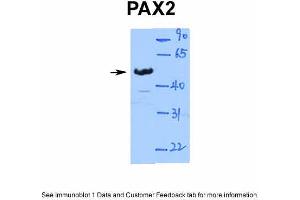 WB Suggested Anti-PAX2 Antibody Titration: 1. (PAX2A Antikörper  (Middle Region))