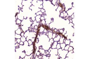 IHC testing of FFPE human lung tissue with C-Reactive Protein antibody at 2ug/ml. (CRP Antikörper  (AA 20-230))