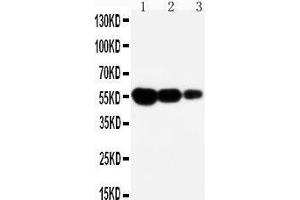 Anti-CD95 antibody, Western blotting Lane 1: Recombinant Mouse FAS Protein 10ng Lane 2: Recombinant Mouse FAS Protein 5ng Lane 3: Recombinant Mouse FAS Protein 2.