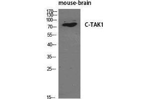 Western Blot (WB) analysis of specific cells using C-TAK1 Polyclonal Antibody.