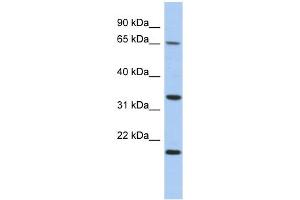 WB Suggested Anti-FAM79B Antibody Titration: 0.