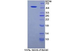SDS-PAGE of Protein Standard from the Kit (Highly purified E. (Fibrillin 1 CLIA Kit)