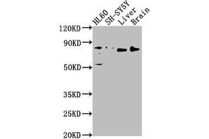 Western Blot Positive WB detected in: HL60 whole cell lysate, SH-SY5Y whole cell lysate, Rat liver tissue, Rat brain tissue All lanes: DNAJC10 antibody at 1:1000 Secondary Goat polyclonal to rabbit IgG at 1/50000 dilution Predicted band size: 92, 87, 38 kDa Observed band size: 80 kDa (DNAJC1 Antikörper  (AA 521-793))