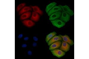 ABIN6257497 and ABIN6275601 staining Hela cells by IF/ICC.