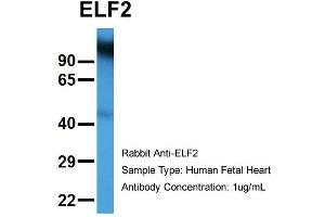 Host:  Rabbit  Target Name:  ELF2  Sample Type:  Human Fetal Heart  Antibody Dilution:  1. (ELF2 Antikörper  (N-Term))