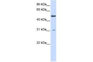 AGXT2L2 antibody used at 0. (AGXT2L2 Antikörper  (N-Term))