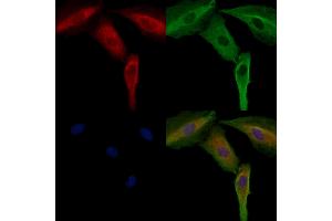ABIN6264545 and ABIN6272404 staining  cells by IF/ICC. (SIK3 Antikörper  (Internal Region))