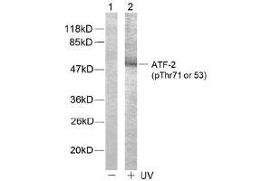 Image no. 2 for anti-Activating Transcription Factor 2 (ATF2) (pThr53), (pThr71) antibody (ABIN196666) (ATF2 Antikörper  (pThr53, pThr71))