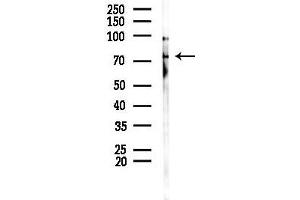 anti-Zinc Finger Protein 7 (ZNF7) (Internal Region) antibody