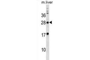 Western Blotting (WB) image for anti-Myelin Protein Zero-Like 3 (MPZL3) antibody (ABIN3000006) (MPZL3 Antikörper)