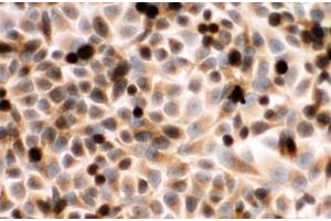 Immunocytochemistry (ICC) image for anti-P450 (Cytochrome) Oxidoreductase (POR) (C-Term) antibody (ABIN3032123)