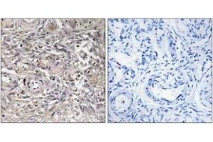 Immunohistochemistry analysis of paraffin-embedded human ovary tissue, using CLDN6 Antibody. (Claudin 6 Antikörper  (AA 81-130))