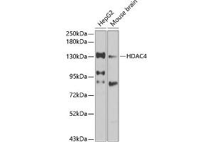 Western blot analysis of extracts of various cell lines, using HD antibody (ABIN6128012, ABIN6141669, ABIN6141672 and ABIN6213648) at 1:1000 dilution.
