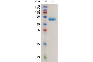 Human R(21-146) Protein, hFc Tag on SDS-PAGE under reducing condition.