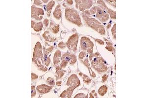 Immunohistochemistry (Paraffin-embedded Sections) (IHC (p)) image for anti-Sphingosine Kinase 1 (SPHK1) (AA 286-315) antibody (ABIN391346)