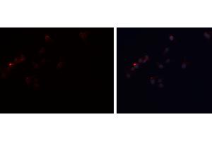 ABIN6277808 staining A-431 cells by ICC/IF.