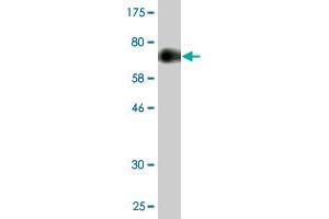 anti-Zinc Finger, C3H1-Type Containing (ZFC3H1) (AA 1-358) antibody