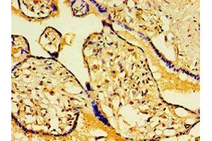 Immunohistochemistry of paraffin-embedded human placenta tissue using ABIN7154837 at dilution of 1:100 (FAM29A Antikörper  (AA 676-955))