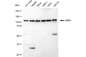 Western blotting analysis using KSR1 antibody (ABIN7799198).