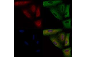 ABIN6258296 and ABIN6274603 staining  cells by IF/ICC.