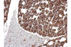 IHC-P Image alpha SNAP antibody [N2C3] detects alpha SNAP protein at cytosol on mouse lung by immunohistochemical analysis. (NAPA Antikörper  (Center))