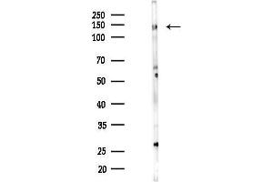 anti-Zinc Finger Protein 217 (ZNF217) (C-Term) antibody