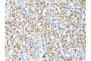 Immunohistochemistry of paraffin-embedded rat ovary using S100A10 antibody. (S100A10 Antikörper)