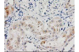 Immunohistochemical staining of paraffin-embedded Human Kidney tissue using anti-ILVBL mouse monoclonal antibody. (ILVBL Antikörper)