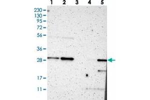Western blot analysis of Lane 1: RT-4, Lane 2: U-251 MG, Lane 3: Human Plasma, Lane 4: Liver, Lane 5: Tonsil with TSPAN13 polyclonal antibody . (TSPAN13 Antikörper)