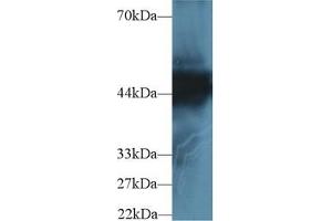 Detection of CK18 in Human Hela cell lysate using Polyclonal Antibody to Cytokeratin 18 (CK18) (Cytokeratin 18 Antikörper  (AA 238-396))