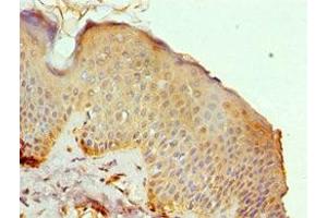 Immunohistochemistry of paraffin-embedded human skin tissue using ABIN7150623 at dilution of 1:100 (Mre11 Antikörper  (AA 1-205))