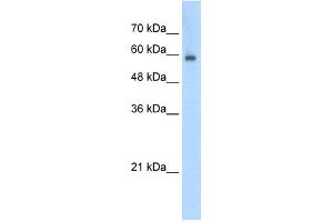 WB Suggested Anti-EIF4G3 Antibody Titration:  0. (EIF4G3 Antikörper  (N-Term))