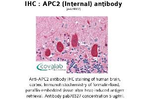 Image no. 1 for anti-APC Regulator of WNT Signaling Pathway 2 (APC2) (Internal Region) antibody (ABIN1731845) (APC2 Antikörper  (Internal Region))