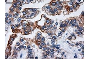 Image no. 1 for anti-Keratin 18 (KRT18) (AA 69-372) antibody (ABIN1491637) (Cytokeratin 18 Antikörper  (AA 69-372))