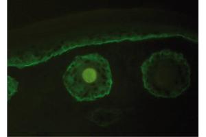 Immunofluorescence image of Collagen type XVII staining in cryosection of murine Skin.