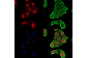 Phospho-ZEB2 (Ser784) Antibody staining Hela cells(heat shock treatment) by IF/ICC.