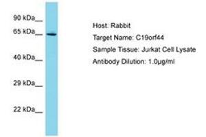 Image no. 1 for anti-Chromosome 19 Open Reading Frame 44 (C19ORF44) (AA 187-236) antibody (ABIN6750701) (C19ORF44 Antikörper  (AA 187-236))
