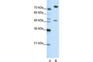 Western Blotting (WB) image for anti-Sjogren Syndrome Antigen B (SSB) antibody (ABIN2462144) (SSB Antikörper)