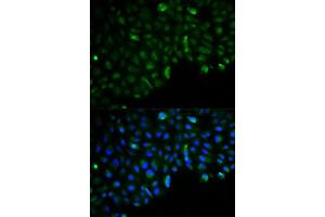 Immunofluorescence analysis of U2OS cells using HK2 antibody. (Hexokinase 2 Antikörper  (AA 1-120))