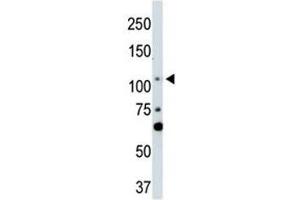 LATS2 antibody used in western blot to detect LATS2 in NIH3T3 cell lysate (LATS2 Antikörper  (AA 228-258))