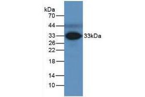 Western blot analysis of Human Serum. (FCN3 Antikörper  (AA 34-297))