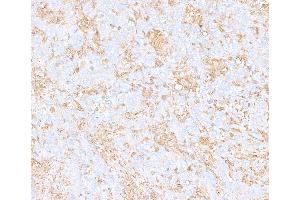 Immunohistochemistry (IHC) image for anti-Cytoskeletal Actin (CIMG_00972) (AA 1-50) antibody (ABIN7449436)