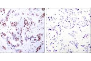 Immunohistochemistry (IHC) image for anti-Myocyte Enhancer Factor 2A (MEF2A) (AA 279-328) antibody (ABIN2889024) (MEF2A Antikörper  (AA 279-328))