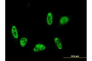 Immunofluorescence of monoclonal antibody to ALPK3 on HeLa cell.