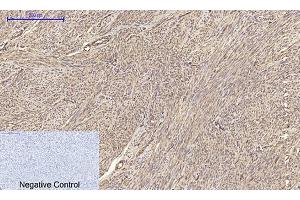 Immunohistochemical analysis of paraffin-embedded human uterus tissue. (Claudin 5 Antikörper  (AA 140-220))