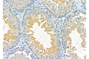 ABIN6259253 and ABIN6275428 at 1/100 staining Rat testis tissue by IHC-P. (PDXDC1 Antikörper  (C-Term))