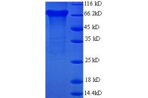 SDS-PAGE (SDS) image for Urease Subunit beta (AA 1-569), (full length) protein (His tag) (ABIN1047875)