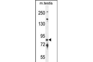 IFT81 Antibody (C-term) (ABIN654472 and ABIN2844206) western blot analysis in mouse testis tissue lysates (35 μg/lane). (IFT81 Antikörper  (C-Term))