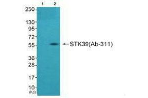 Western blot analysis of extracts from A549 cells using STK39 (Ab-311) antibody,The lane on the left is treated with synthesized peptide. (STK39 Antikörper  (Ser311))